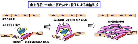 ↑ 仕組み